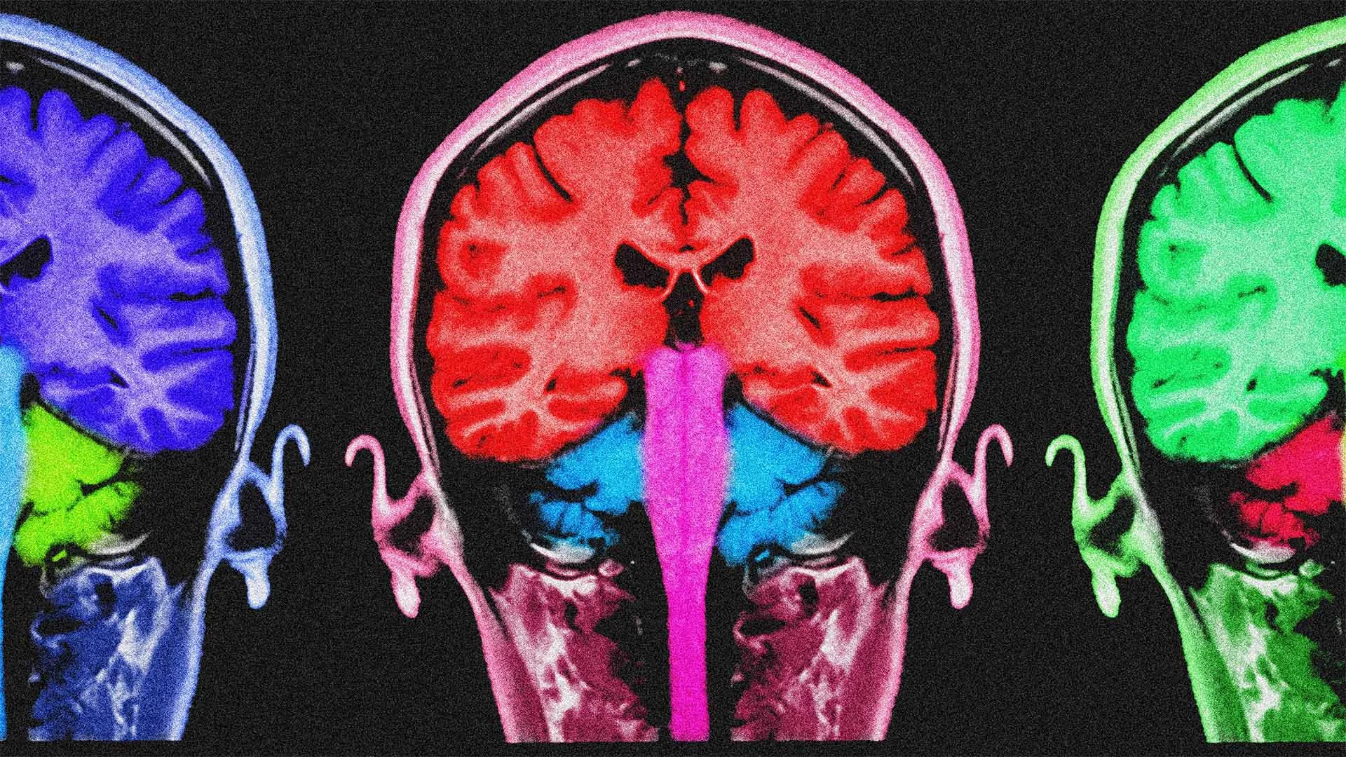 Photo inspiration: Impact Of Too Much Information On Brain Reference: New Science Too Much Grit Can Actually Damage Your Brain