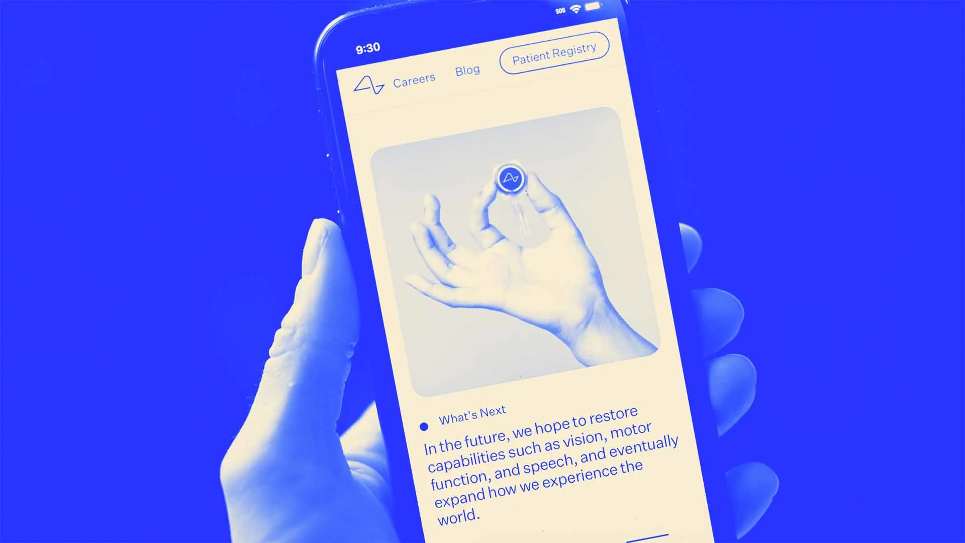 Neuralink Says a Second Patient Controlled a Computer Minutes After  Activating a Brain Implant