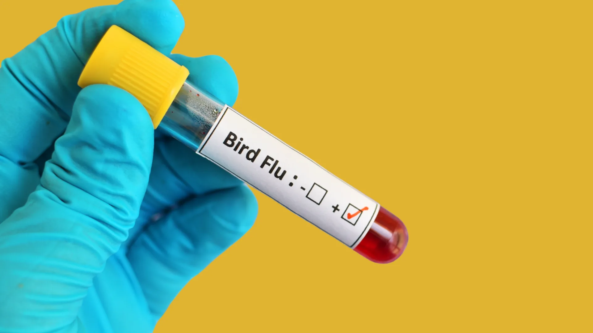 CDC Suggests Quick Bird Flu Testing for Hospitalized Patients