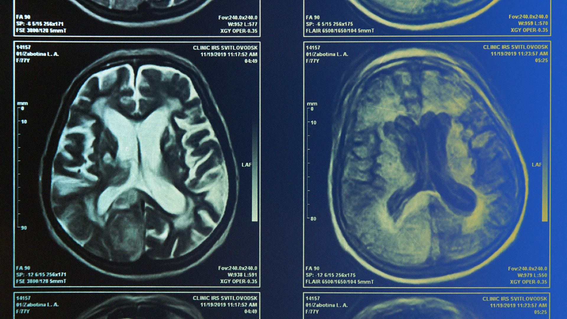 Want to Make Better Decisions? A New Study Shows How Your Brain Chooses Which Signals Matter