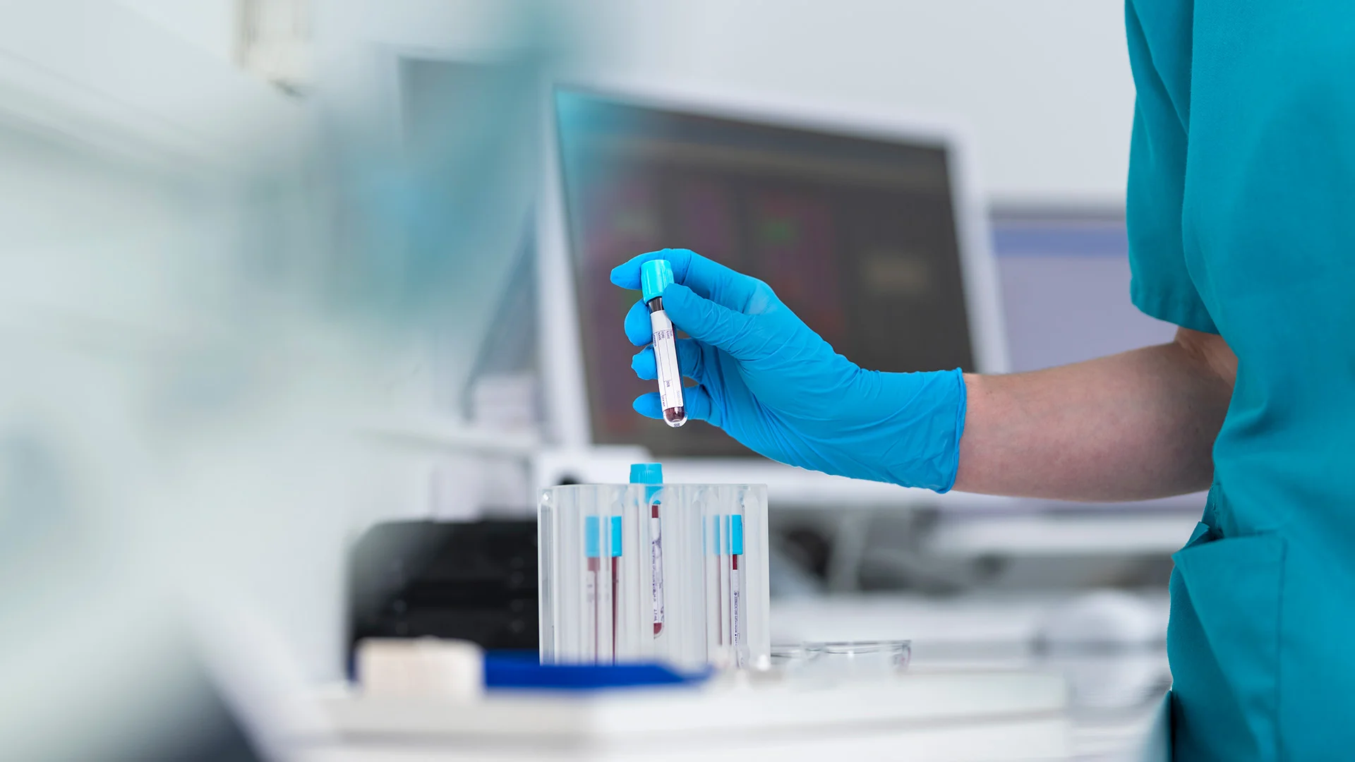 This Controversial Cancer Test Just Passed a Key FDA Vote. Here’s Why It’s Dividing Experts